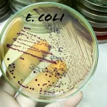 Indiana University researcher sentenced for smuggling E. coli into US